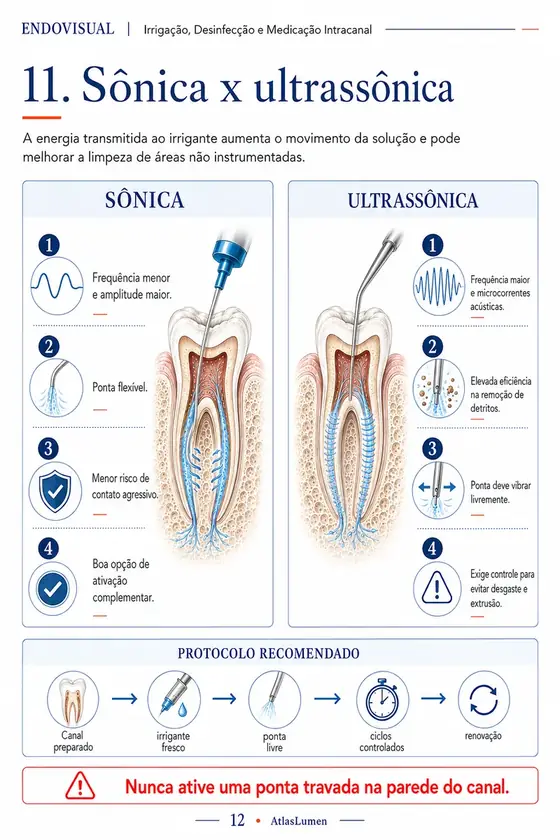 Ficha EndoVisual — Sônica x ultrassônica