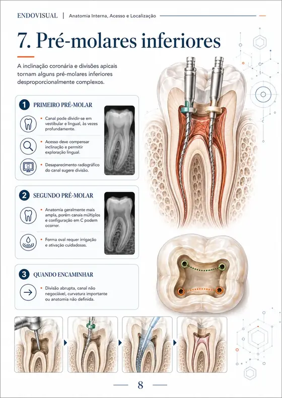 Ficha EndoVisual — Pré-molares inferiores