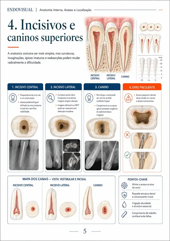 Ficha EndoVisual — Incisivos e caninos superiores