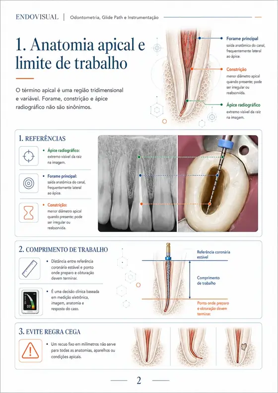 Ficha EndoVisual — Anatomia apical e limite de trabalho