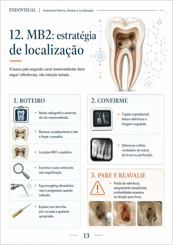 Ficha EndoVisual — MB2: estratégia de localização