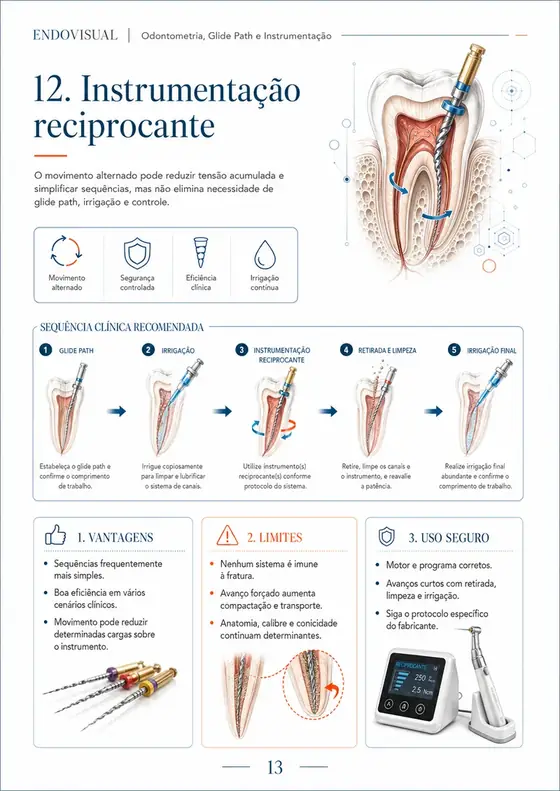 Ficha EndoVisual — Instrumentação reciprocante