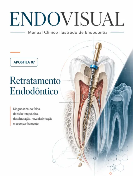 Capa do manual EndoVisual — Retratamento Endodôntico
